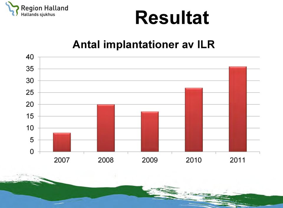 implantationer av ILR