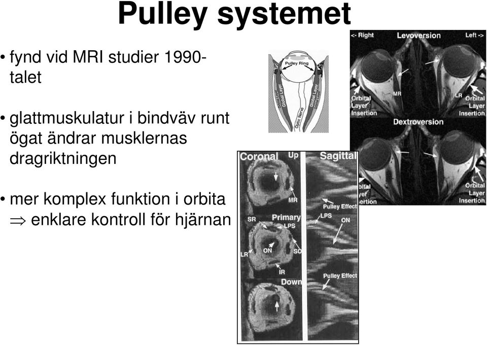 musklernas dragriktningen Pulley systemet