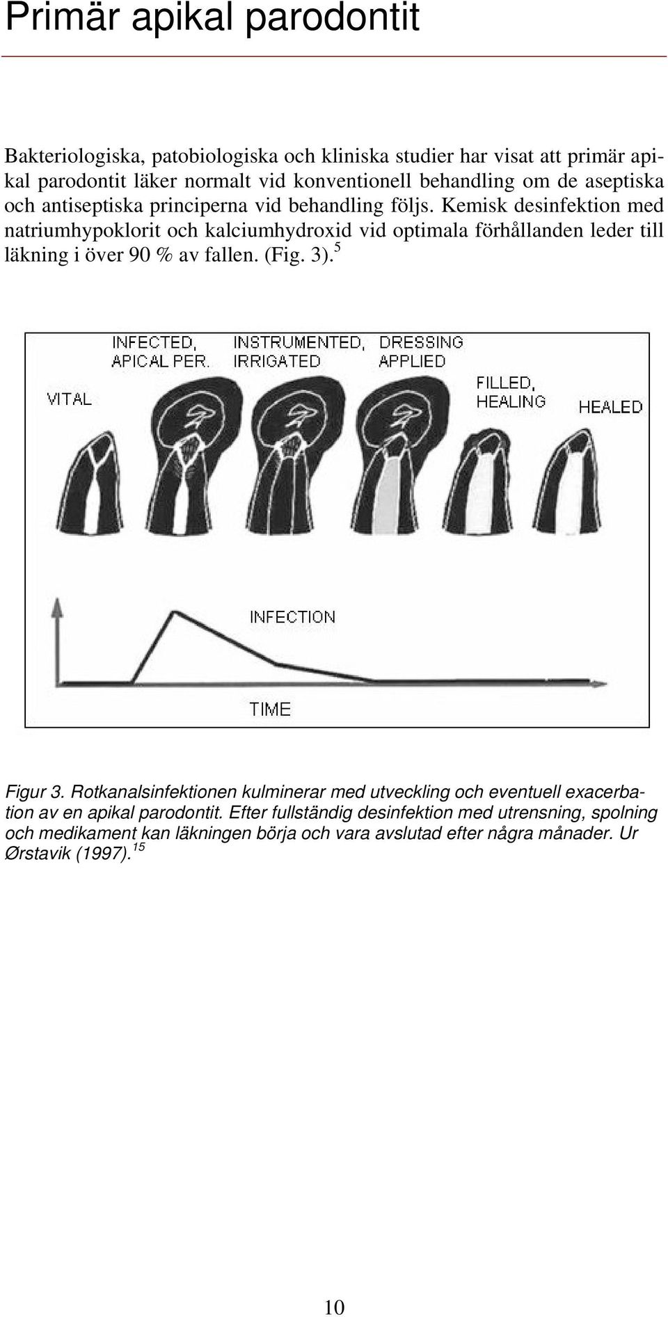 Kemisk desinfektion med natriumhypoklorit och kalciumhydroxid vid optimala förhållanden leder till läkning i över 90 % av fallen. (Fig. 3). 5 Figur 3.