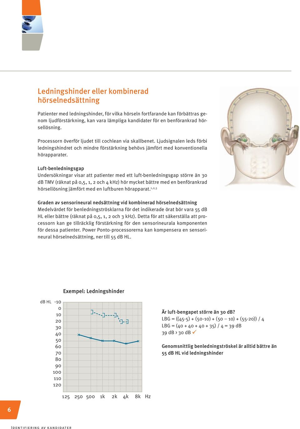 Luft-benledningsgap Undersökningar visar att patienter med ett luft-benledningsgap större än 30 db TMV (räknat på 0,5, 1, 2 och 4 khz) hör mycket bättre med en benförankrad hörsellösning jämfört med