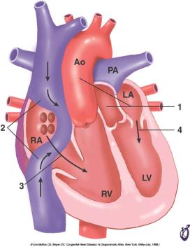 Patients with Mustard operation cannot increase stroke volume during dobutamine stress MRI 12 Mustard compared with 11 cctga CO is limited by