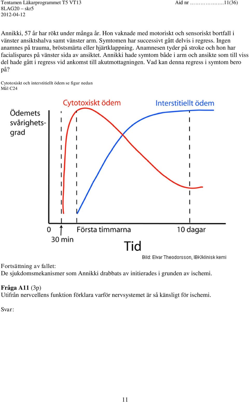 Anamnesen tyder på stroke och hon har facialispares på vänster sida av ansiktet.