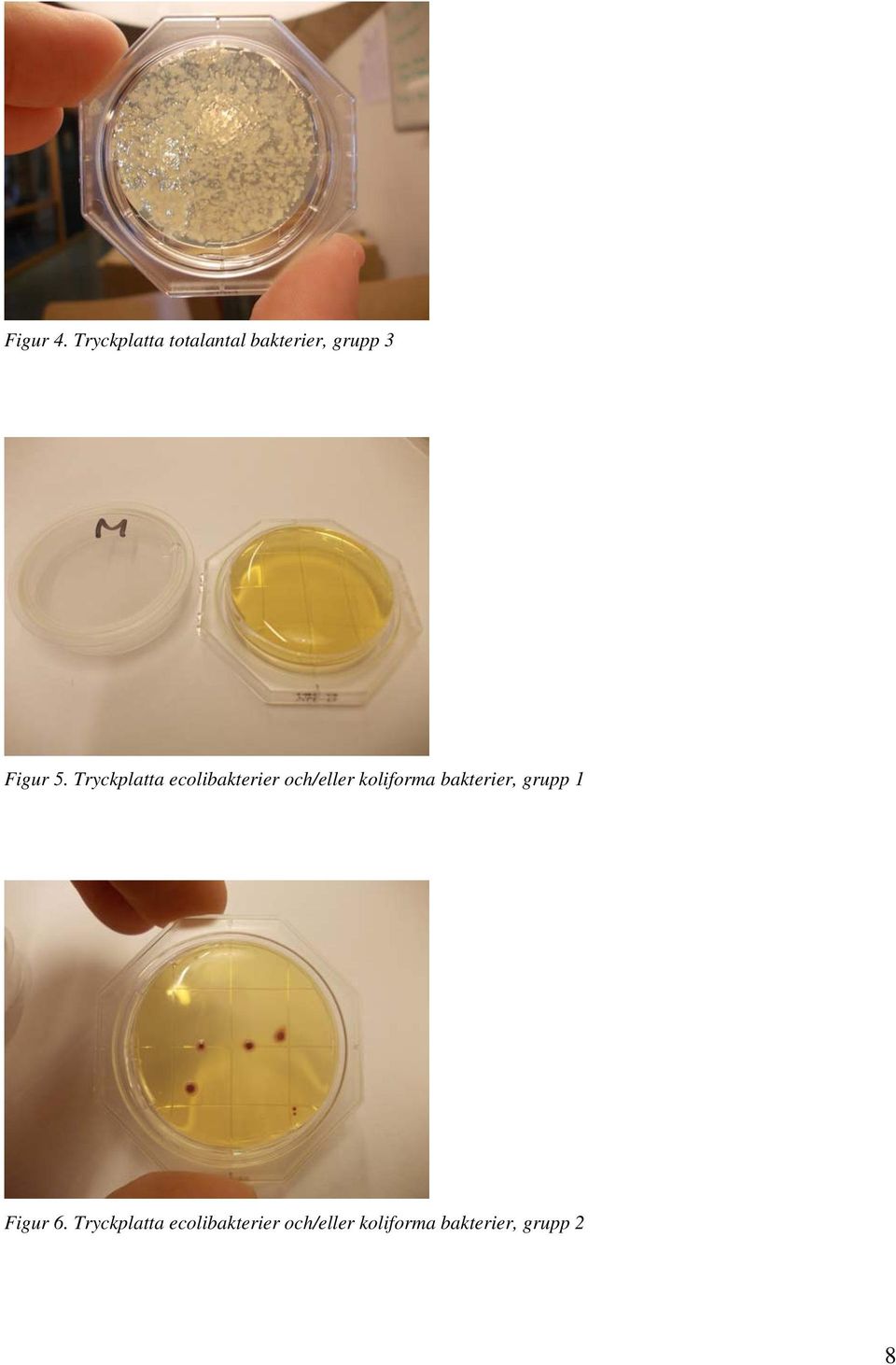Tryckplatta ecolibakterier och/eller koliforma