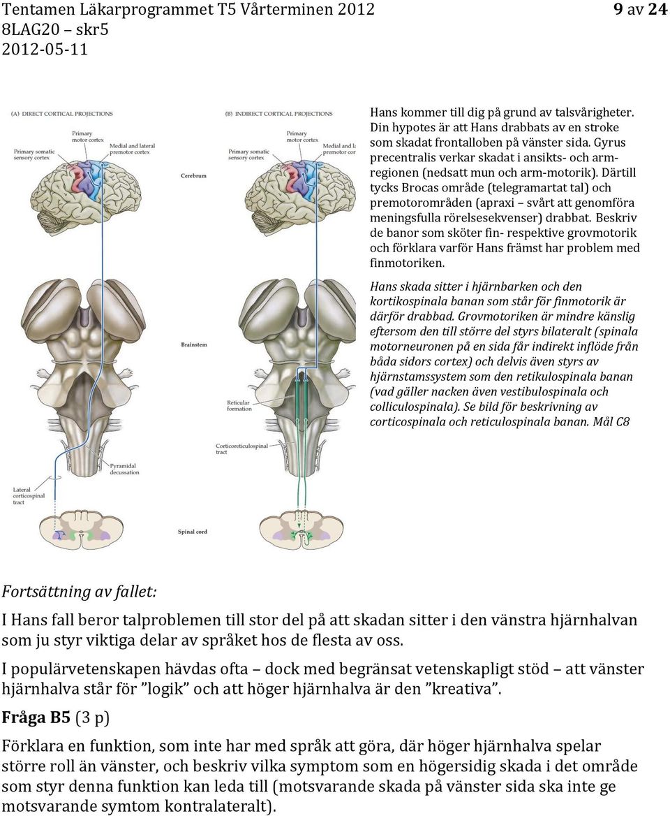 Därtill tycks Brocas område (telegramartat tal) och premotorområden (apraxi svårt att genomföra meningsfulla rörelsesekvenser) drabbat.