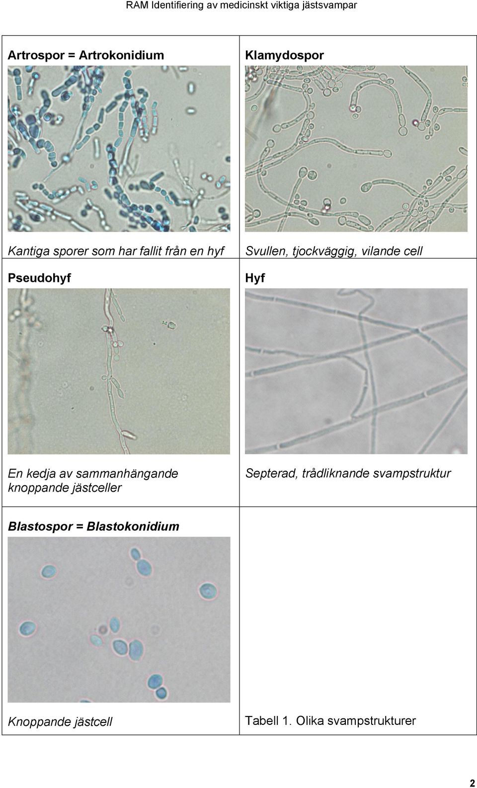 cell Pseudohyf Hyf En kedja av sammanhängande knoppande jästceller Septerad,