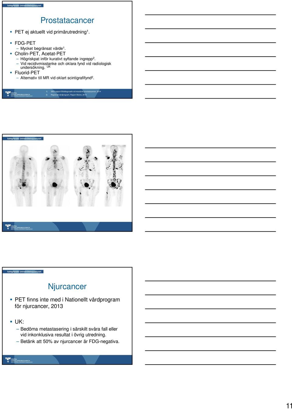 UK Fluorid-PET Alternativ till MR vid oklart scintigrafifynd 2.