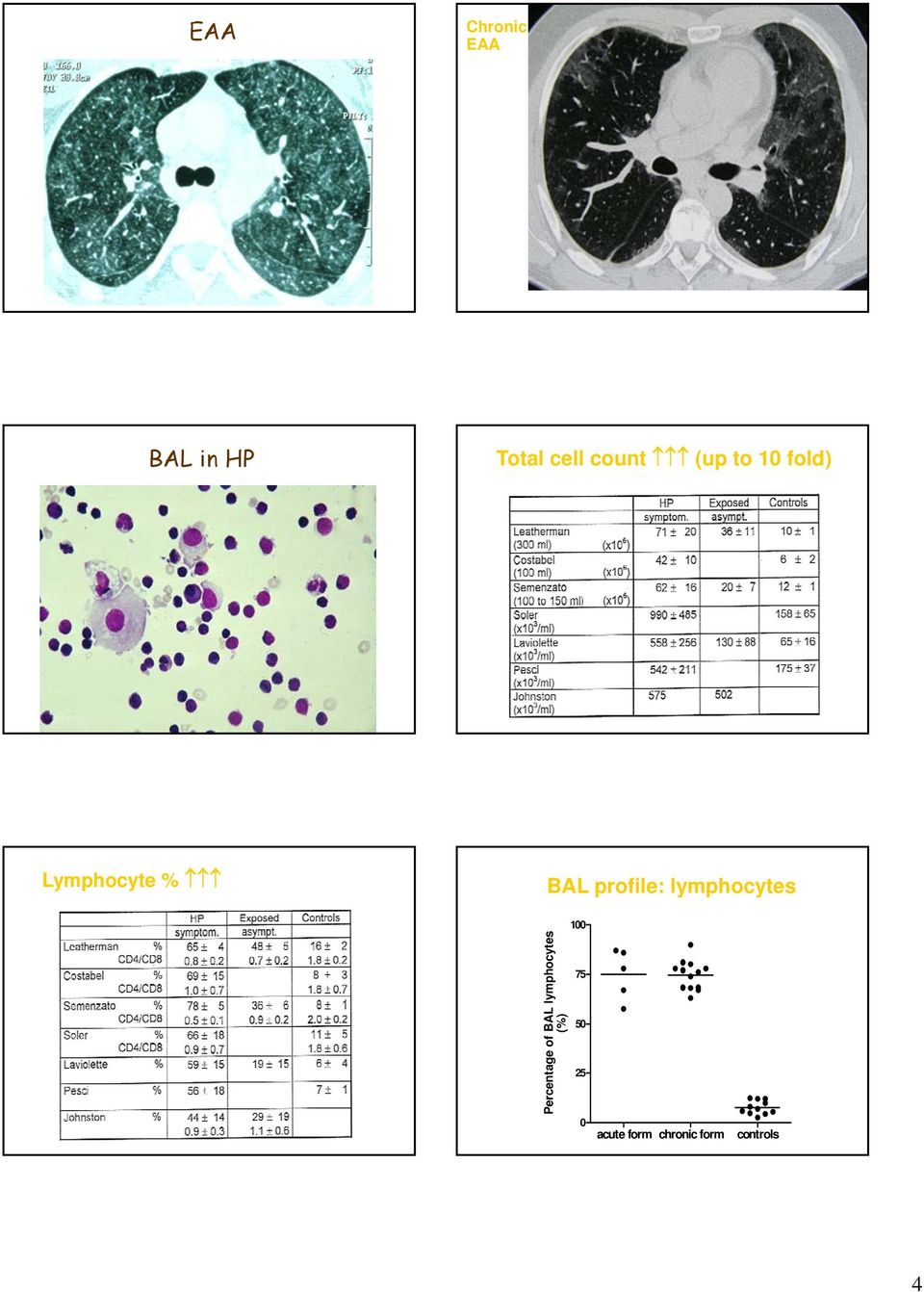 lymphocytes 100 ymphocytes 75 Percentage of