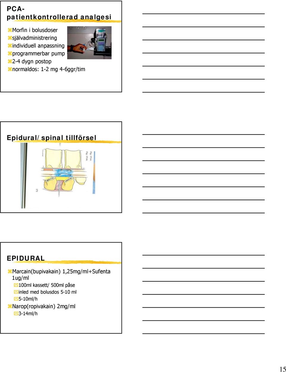 spinal tillförsel EPIDURAL Marcain(bupivakain) 1,25mg/ml+Sufenta 1ug/ml 100ml