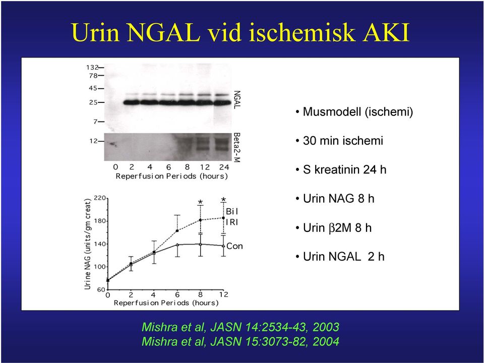 Urin β2m 8 h Urin NGAL 2 h Mishra et al, JASN