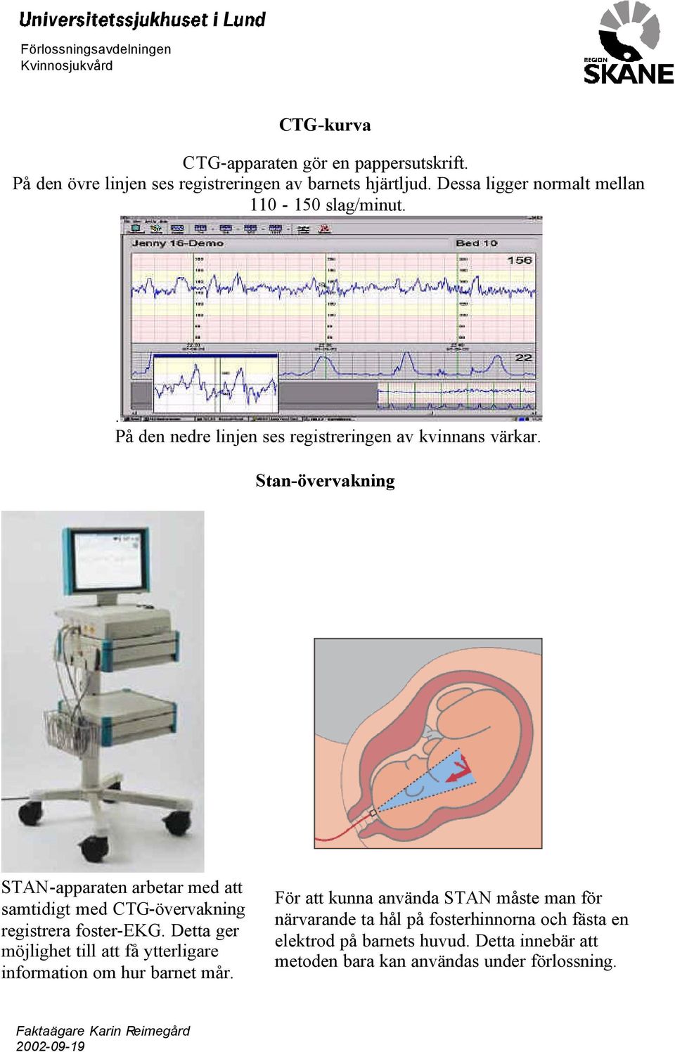 Stan-övervakning STAN-apparaten arbetar med att samtidigt med CTG-övervakning registrera foster-ekg.