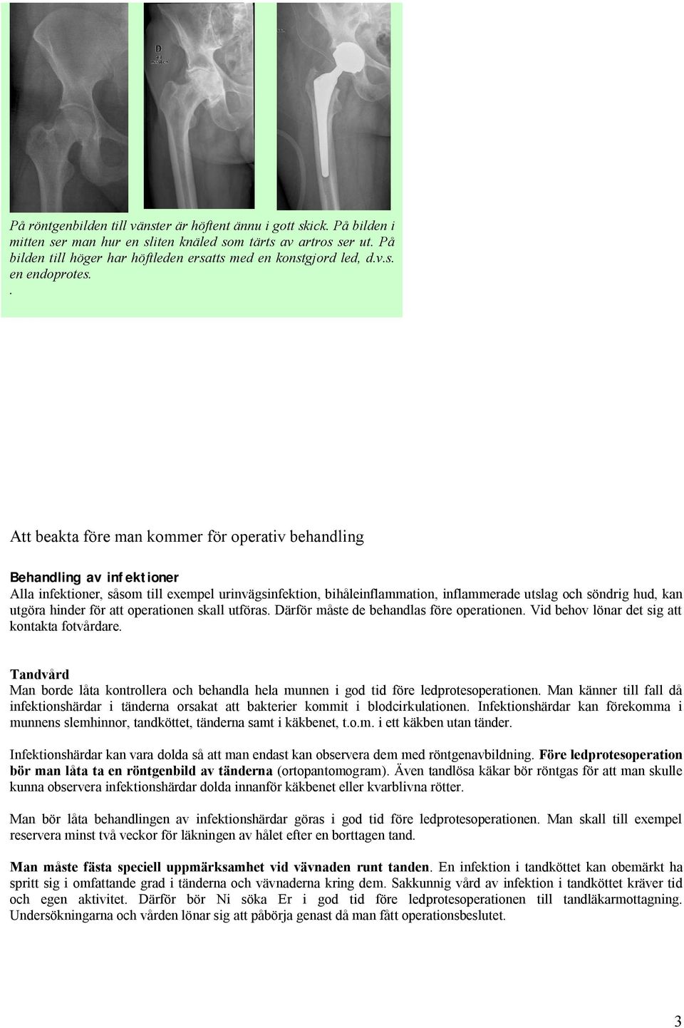 . Att beakta före man kommer för operativ behandling Behandling av infektioner Alla infektioner, såsom till exempel urinvägsinfektion, bihåleinflammation, inflammerade utslag och söndrig hud, kan