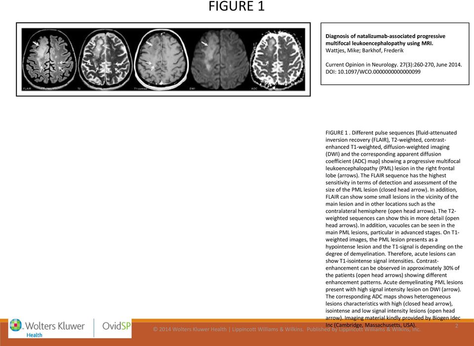 Different pulse sequences [fluid-attenuated inversion recovery (FLAIR), T2-weighted, contrastenhanced T1-weighted, diffusion-weighted imaging (DWI) and the corresponding apparent diffusion