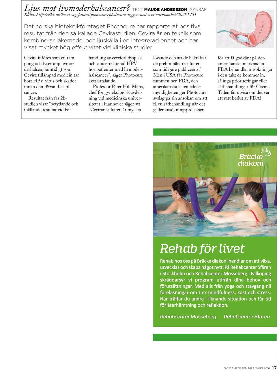 Cevira är en teknik som kombinerar läkemedel och ljuskälla i en integrerad enhet och har visat mycket hög effektivitet vid kliniska studier.