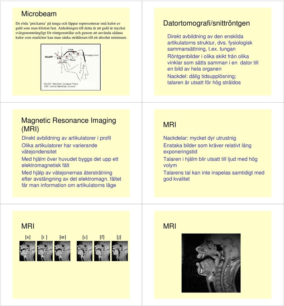 Datortomografi/snittröntgen Direkt avbildning av den enskilda artikulatorns struktur, dvs. fysiologisk sammansättning, t.ex.