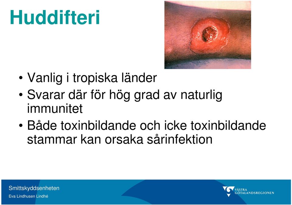 immunitet Både toxinbildande och icke