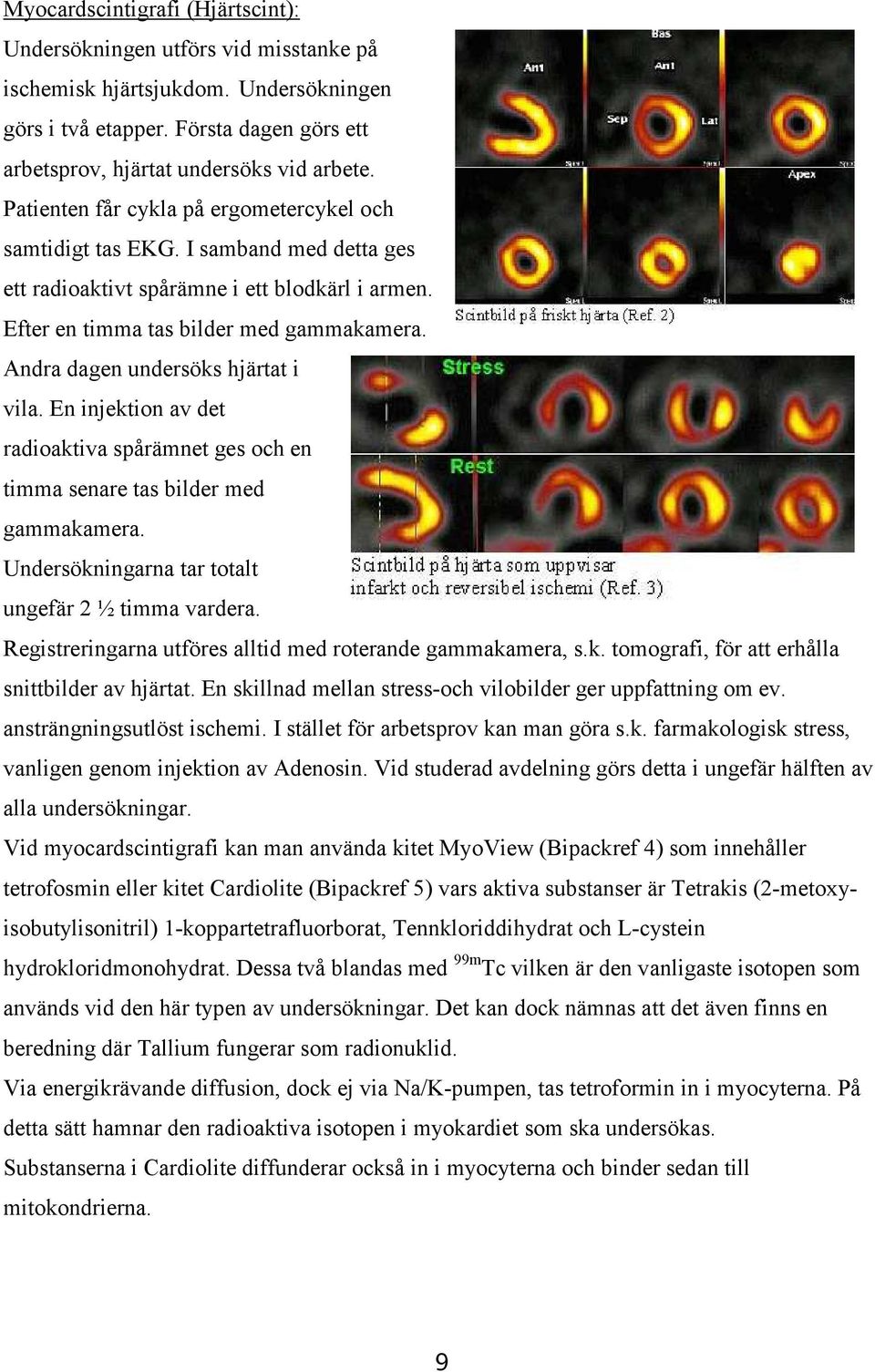 Andra dagen undersöks hjärtat i vila. En injektion av det radioaktiva spårämnet ges och en timma senare tas bilder med gammakamera. Undersökningarna tar totalt ungefär 2 ½ timma vardera.