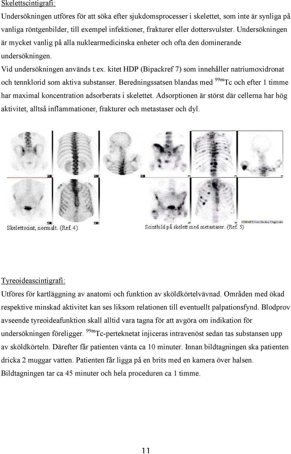 kitet HDP (Bipackref 7) som innehåller natriumoxidronat och tennklorid som aktiva substanser. Beredningssatsen blandas med 99m Tc och efter 1 timme har maximal koncentration adsorberats i skelettet.