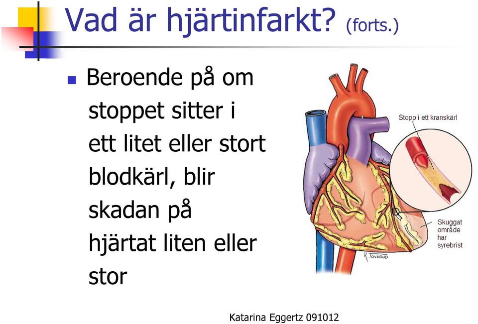 ett litet eller stort blodkärl,