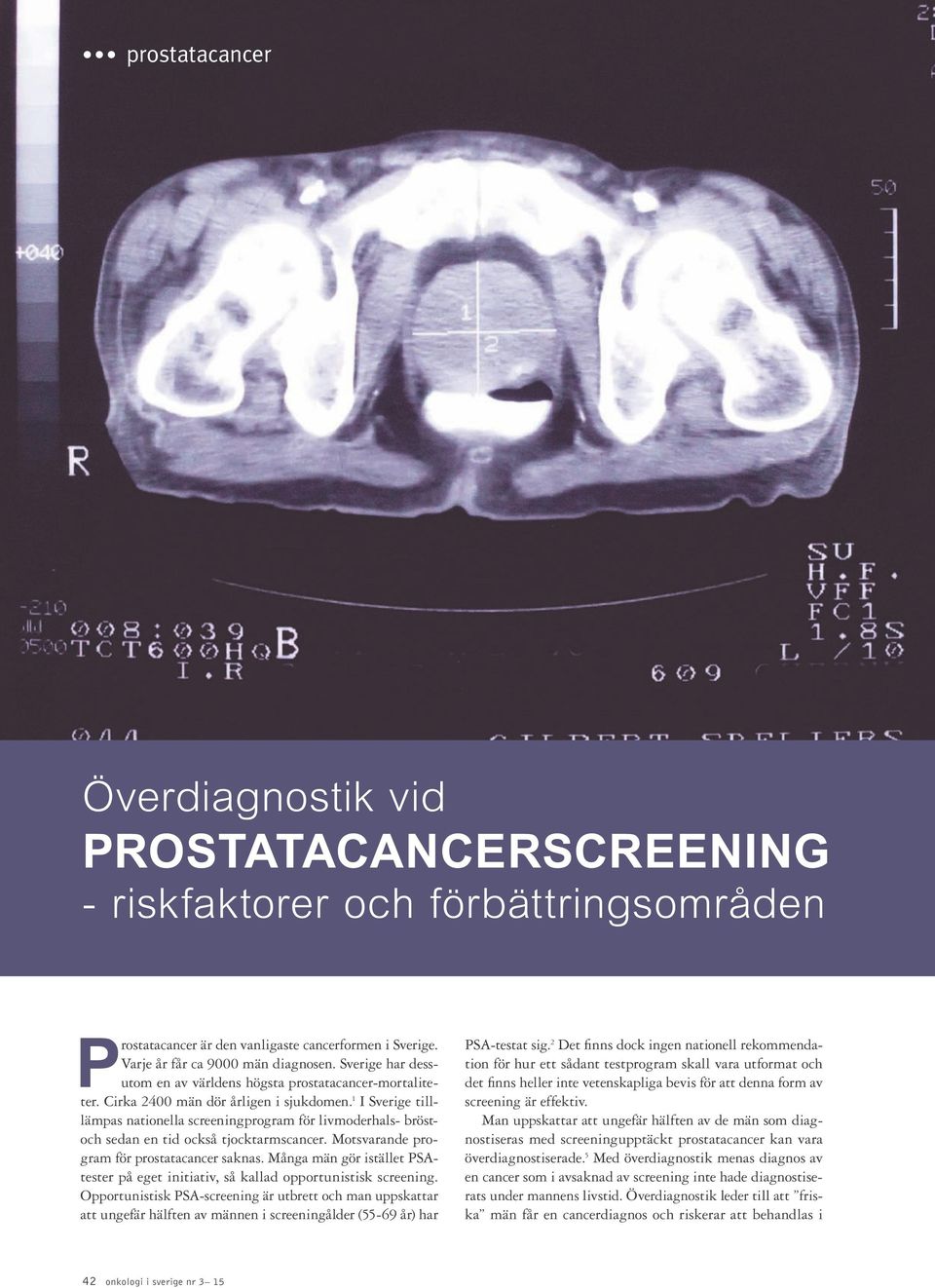 1 I Sverige tilllämpas nationella screeningprogram för livmoderhals- bröstoch sedan en tid också tjocktarmscancer. Motsvarande program för saknas.