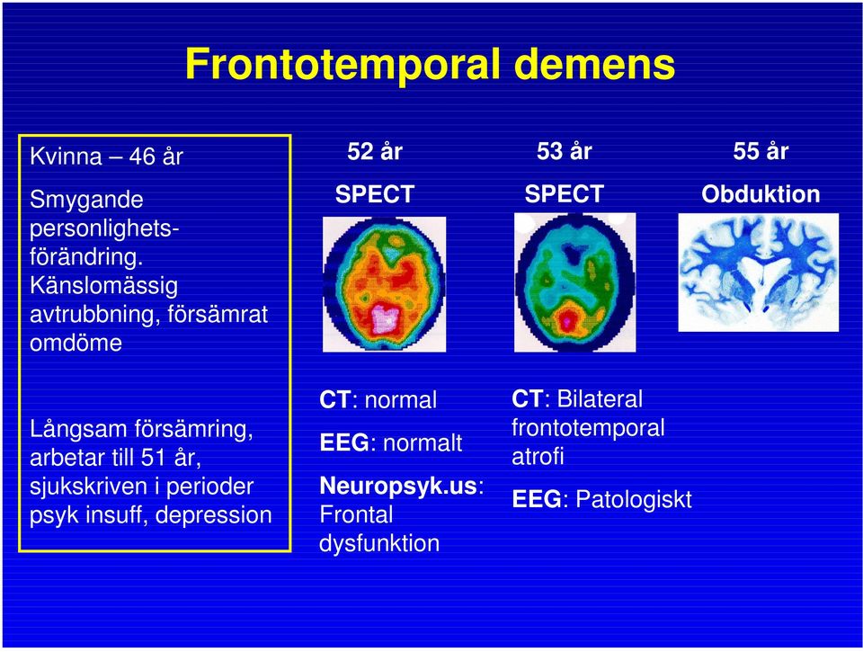 arbetar till 51 år, sjukskriven i perioder psyk insuff, depression CT: normal EEG: