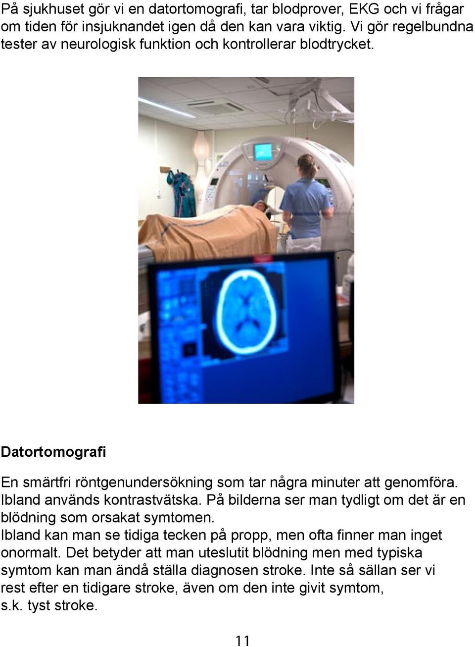 Ibland används kontrastvätska. På bilderna ser man tydligt om det är en blödning som orsakat symtomen.