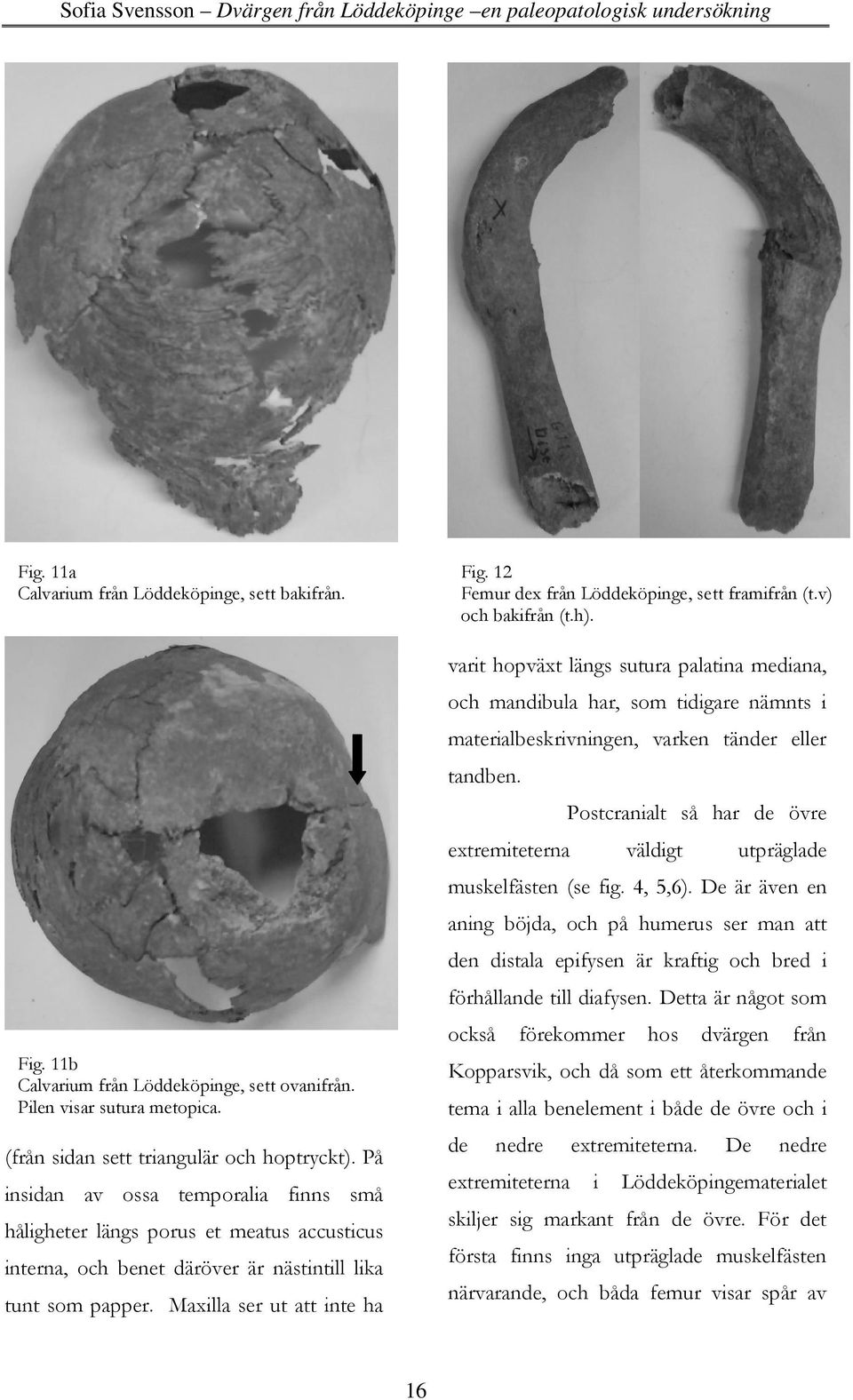 Postcranialt så har de övre extremiteterna väldigt utpräglade muskelfästen (se fig. 4, 5,6).