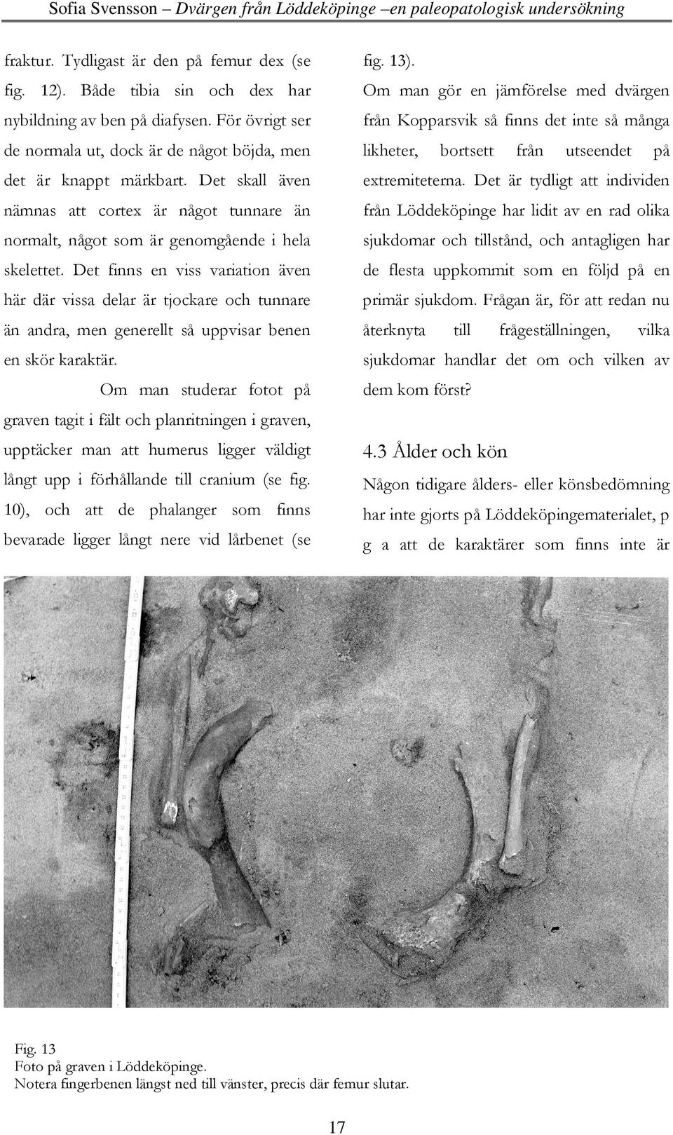 För övrigt ser från Kopparsvik så finns det inte så många de normala ut, dock är de något böjda, men likheter, det är knappt märkbart. Det skall även extremiteterna.