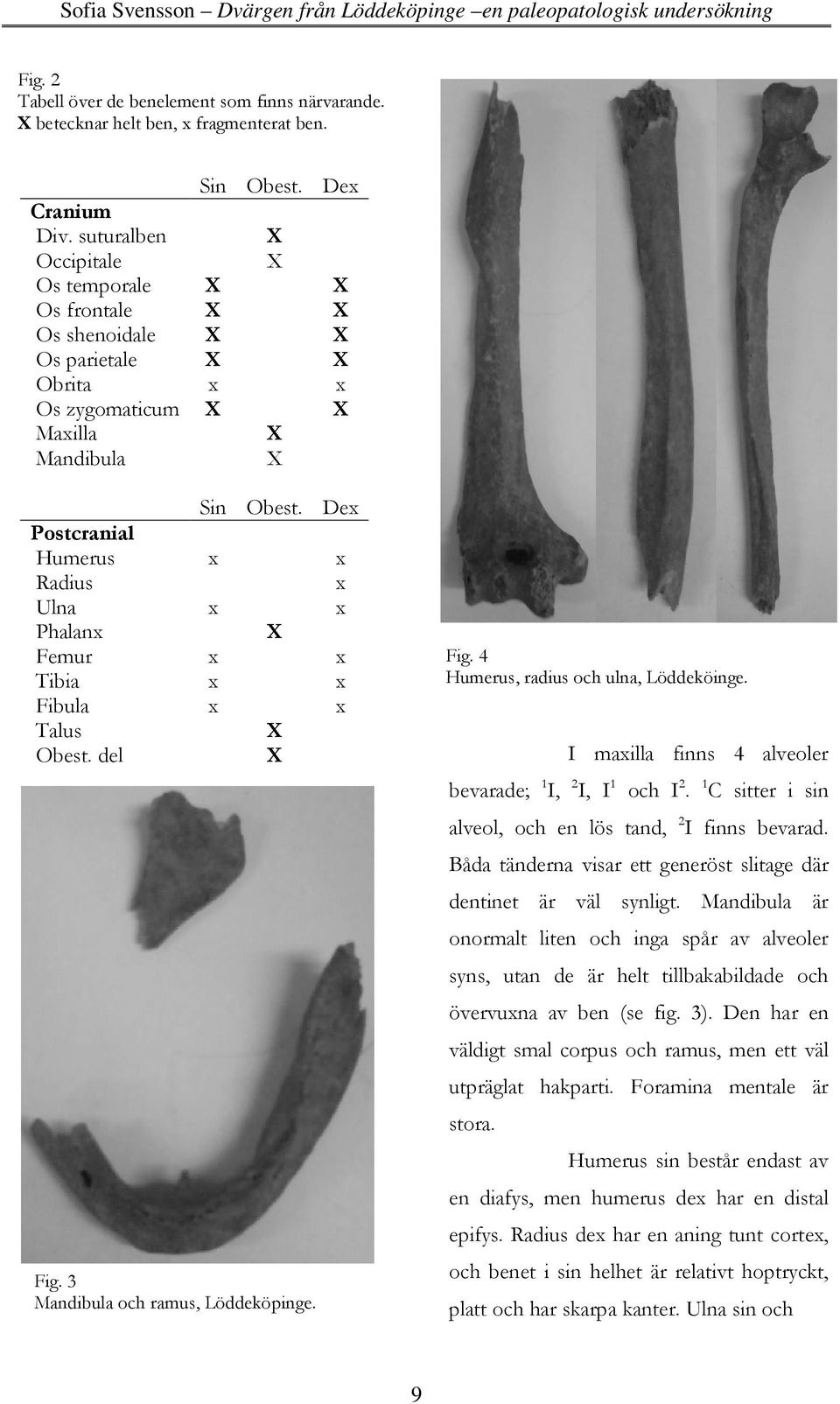 Dex Postcranial Humerus x x Radius x Ulna x x Phalanx X Femur x x Fig. 4 Tibia x x Humerus, radius och ulna, Löddeköinge. Fibula x x Talus X Obest. del X I maxilla finns 4 alveoler Fig.