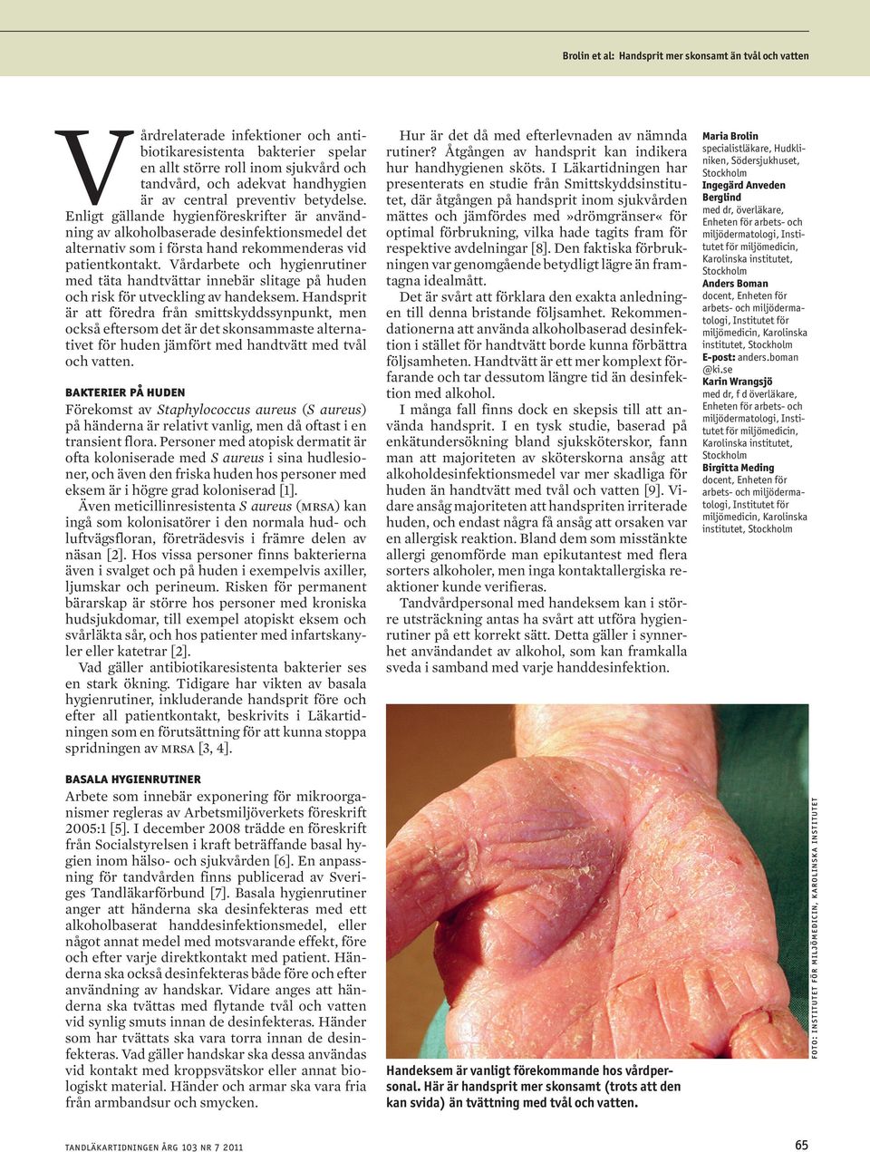Vårdarbete och hygienrutiner med täta handtvättar innebär slitage på huden och risk för utveckling av handeksem.