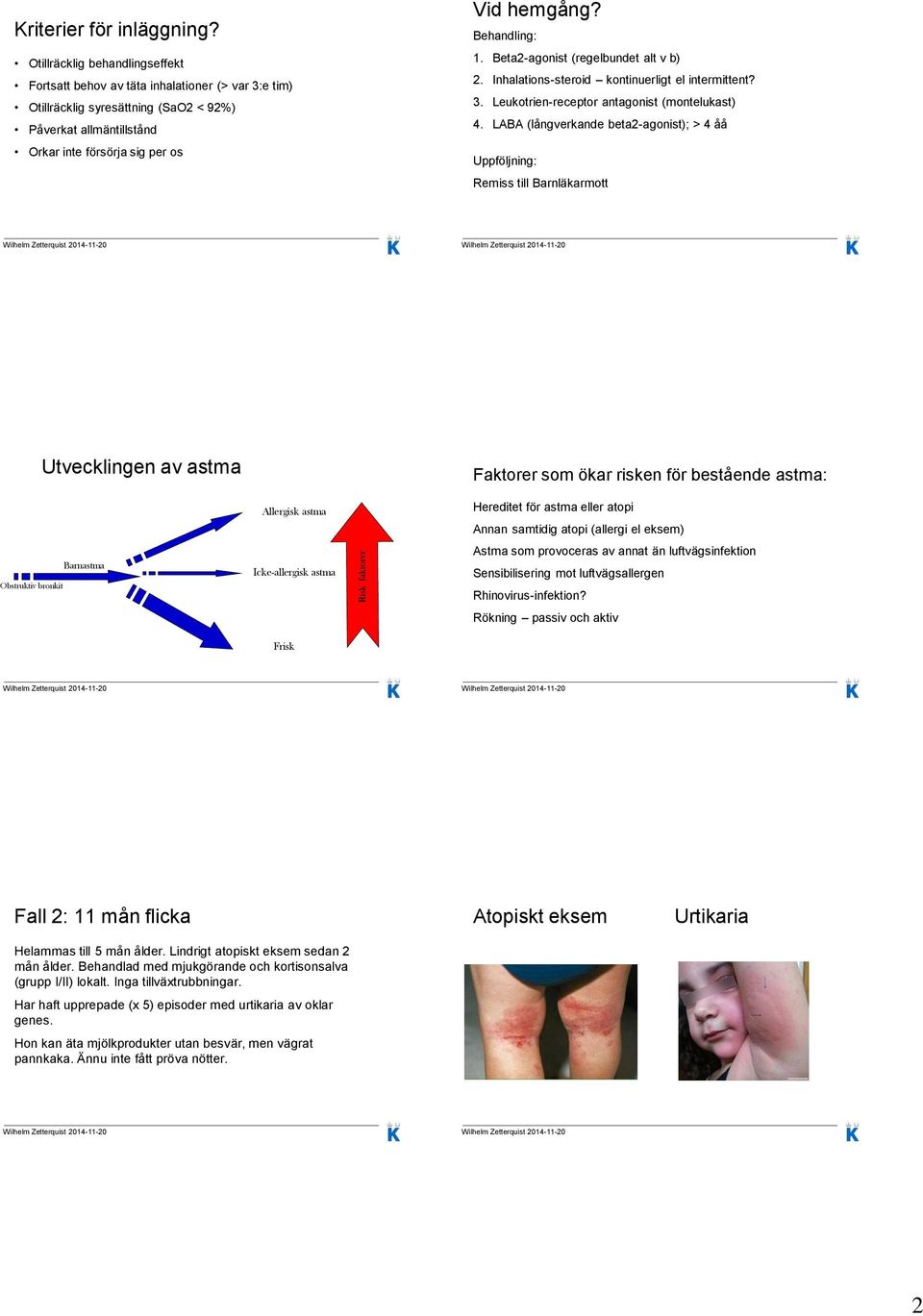 Behandling: 1. Beta2-agonist (regelbundet alt v b) 2. Inhalations-steroid kontinuerligt el intermittent? 3. Leukotrien-receptor antagonist (montelukast) 4.