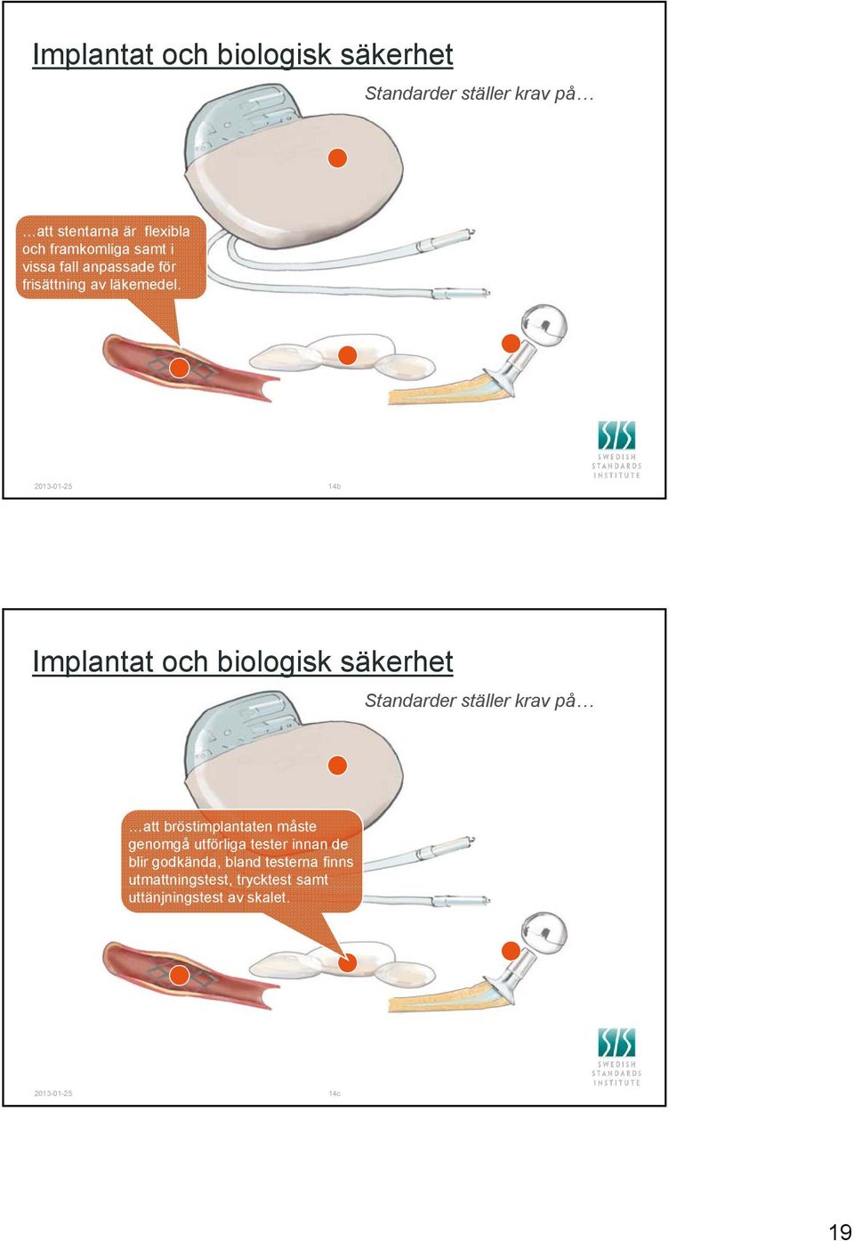 2013-01-25 14b Implantat och biologisk säkerhet att bröstimplantaten måste genomgå