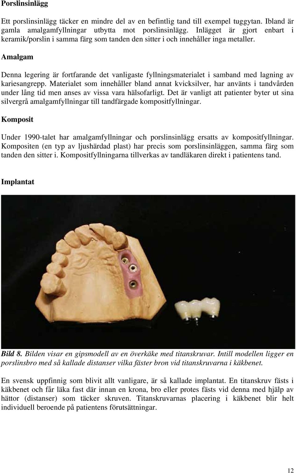 Amalgam Denna legering är fortfarande det vanligaste fyllningsmaterialet i samband med lagning av kariesangrepp.