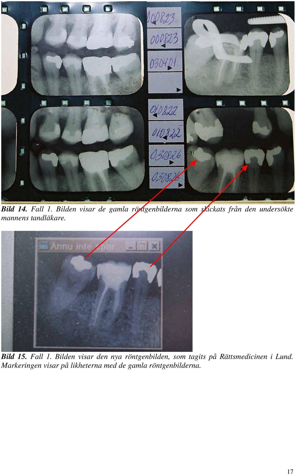 undersökte mannens tandläkare. Bild 15. Fall 1.
