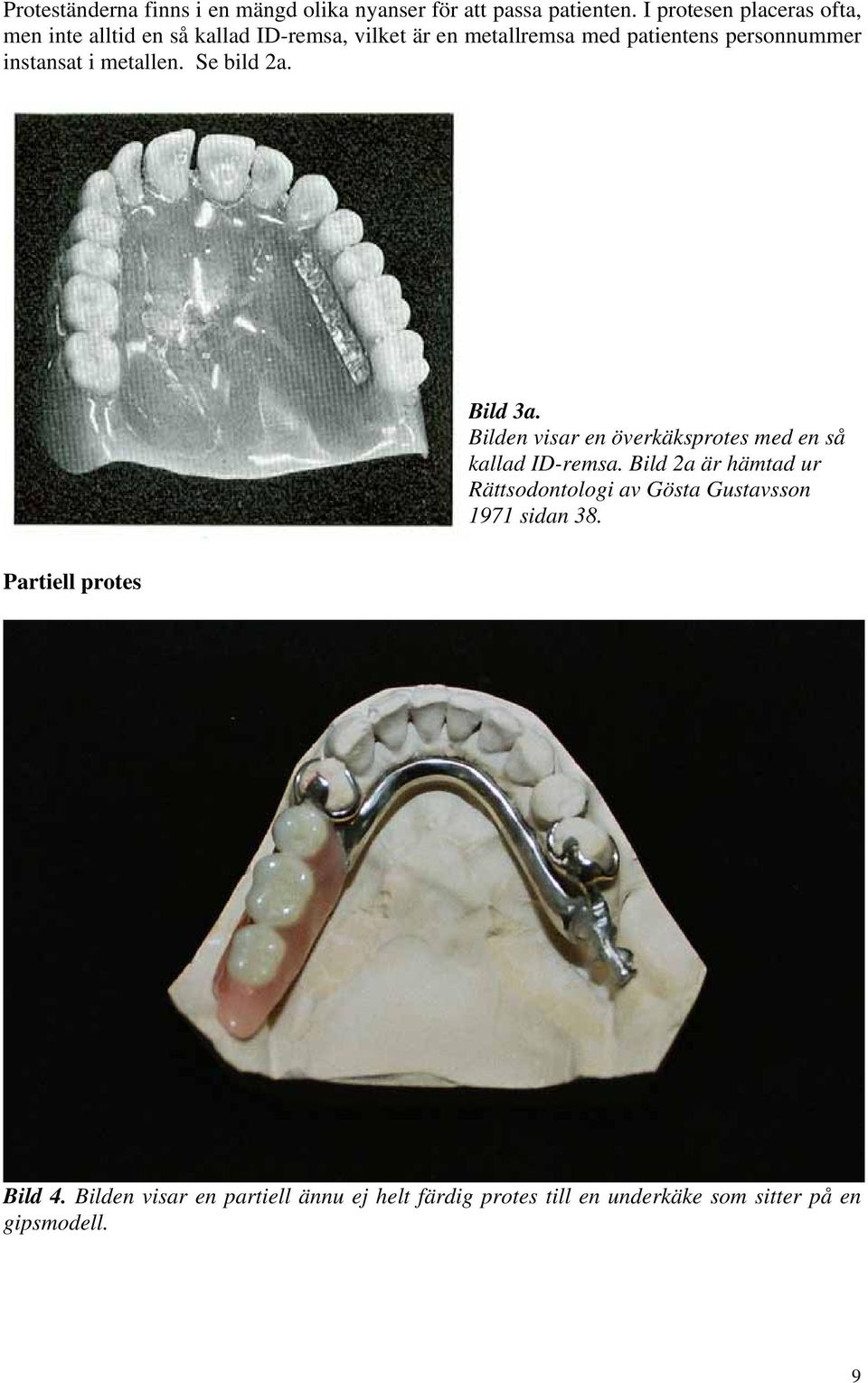 instansat i metallen. Se bild 2a. Bild 3a. Bilden visar en överkäksprotes med en så kallad ID-remsa.