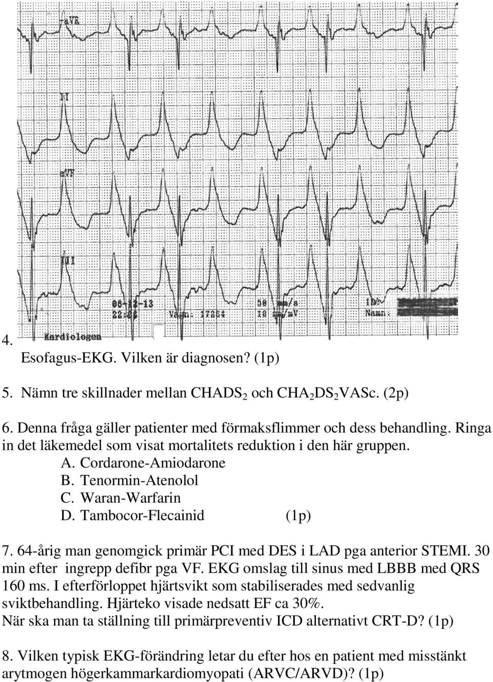 64-årig man genomgick primär PCI med DES i LAD pga anterior STEMI. 30 min efter ingrepp defibr pga VF. EKG omslag till sinus med LBBB med QRS 160 ms.