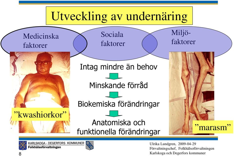 behov Minskande förråd kwashiorkor Biokemiska