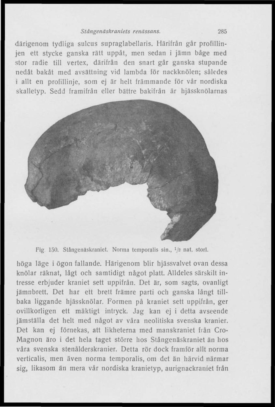 således i allt en profillinje, som ej är helt främmande för vår nordiska skalletyp. Sedd framifrån eller bättre bakifrån är hjässknölarnas Fig 150. Stångenäskraniet. Norma temporalis sin.,! / 2 na t- storl.