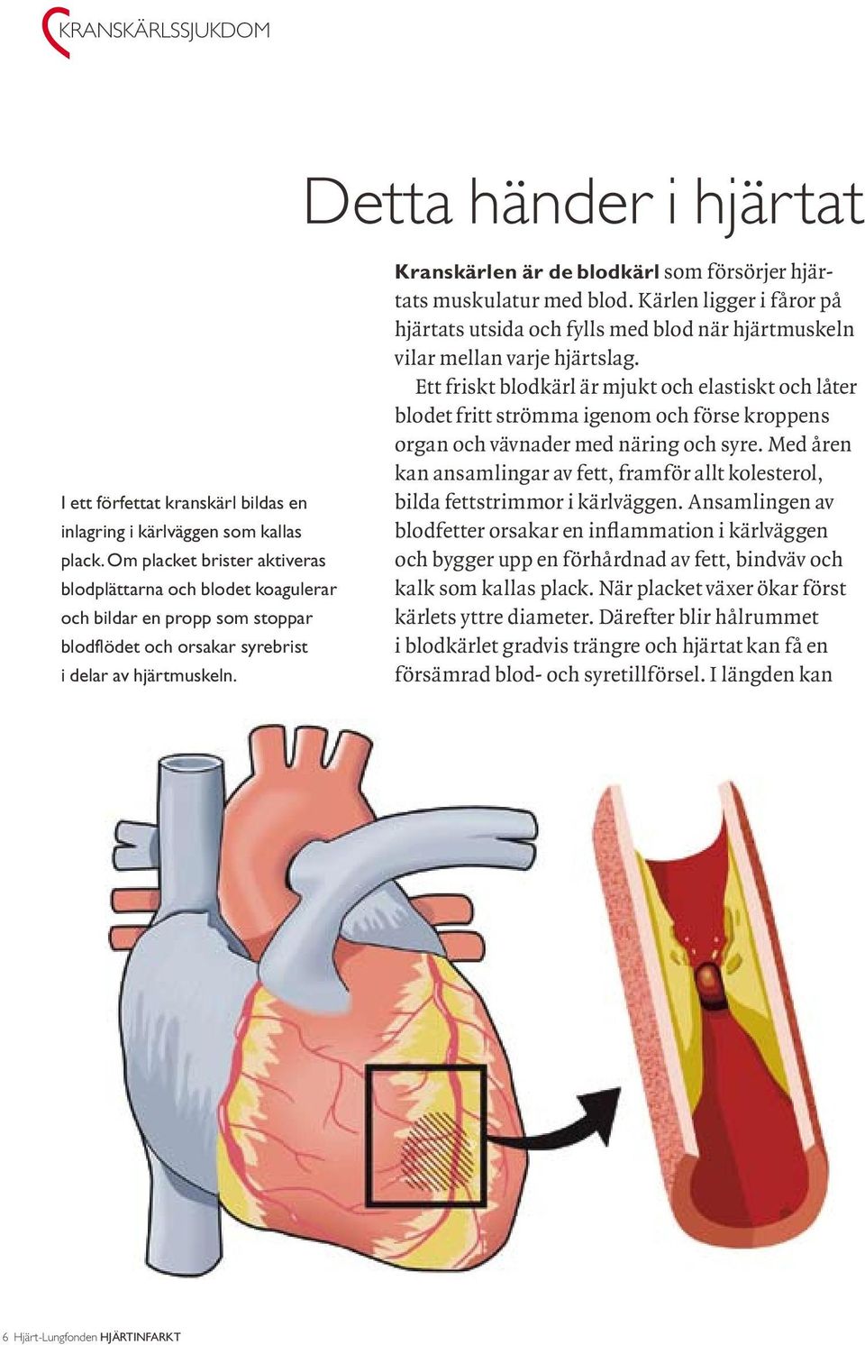 Kranskärlen är de blodkärl som försörjer hjärtats muskulatur med blod. Kärlen ligger i fåror på hjärtats utsida och fylls med blod när hjärtmuskeln vilar mellan varje hjärtslag.