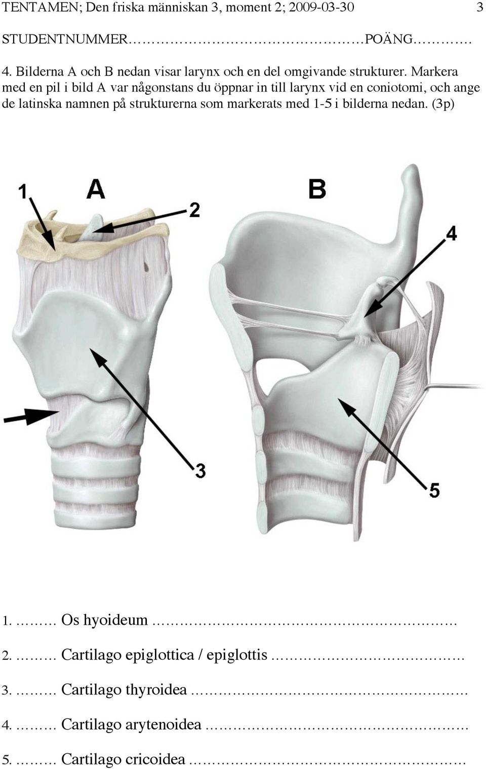 Markera med en pil i bild A var någonstans du öppnar in till larynx vid en coniotomi, och ange de latinska