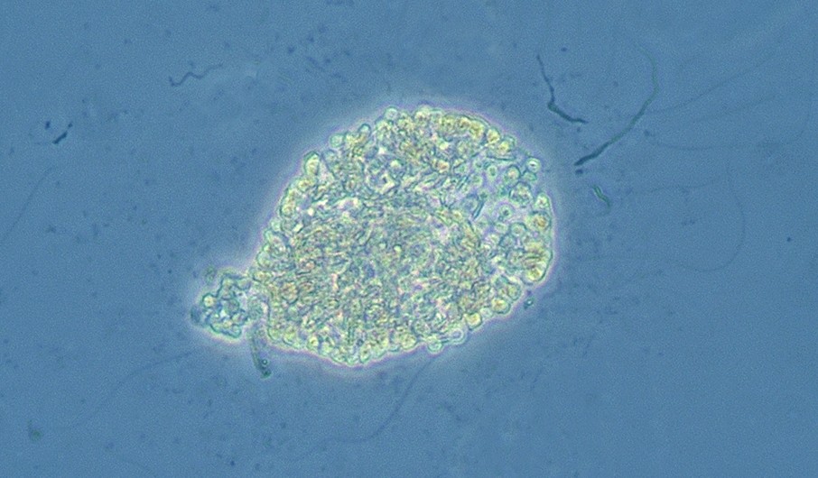 Planktonalgen Gonyostomum semen Medins Biologi AB Företagsvägen 2 435 33