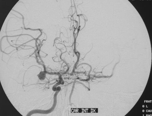 Funktionell MRI MR-perfusion MR spektroskopi DTI