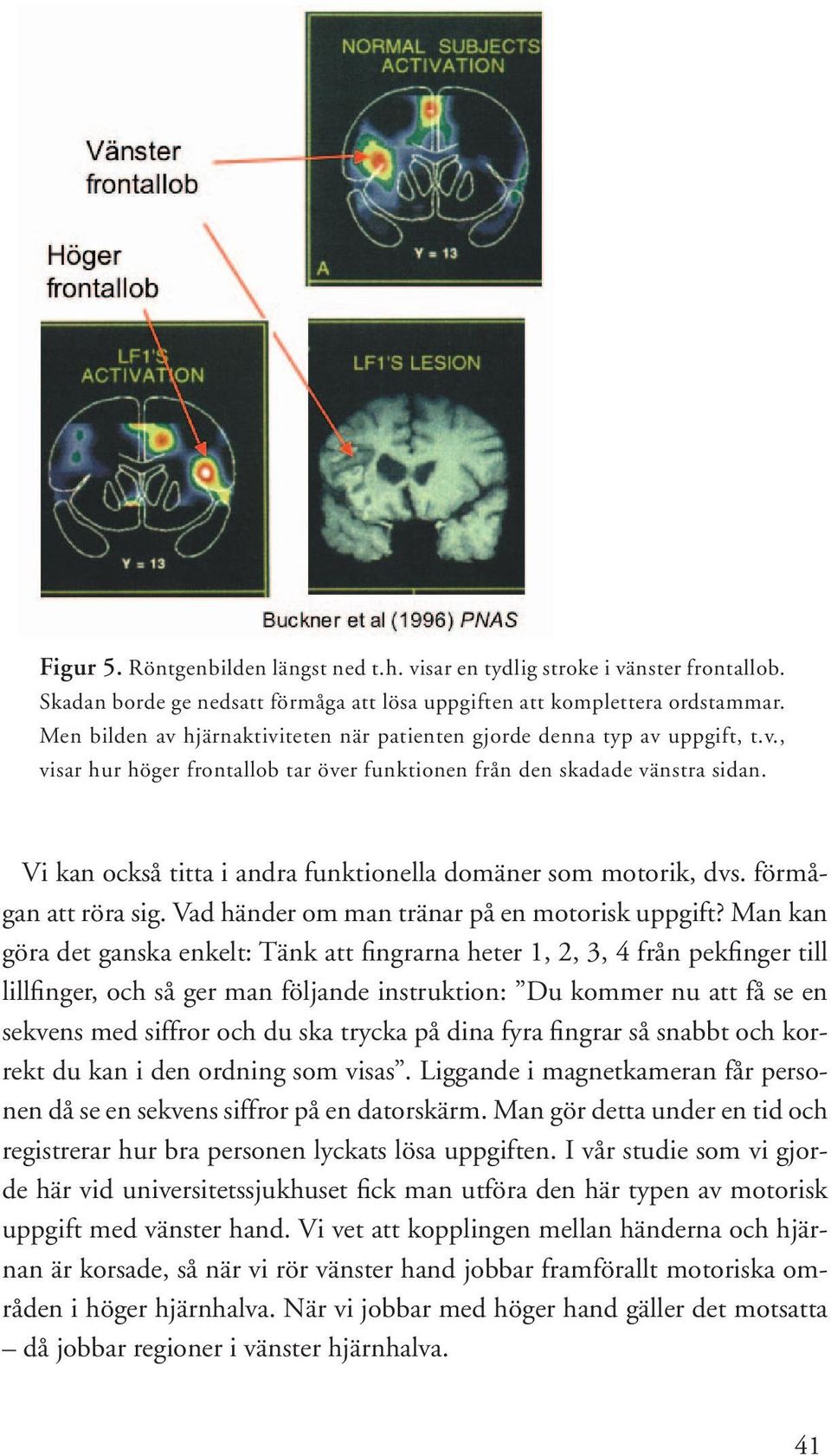 Vi kan också titta i andra funktionella domäner som motorik, dvs. förmågan att röra sig. Vad händer om man tränar på en motorisk uppgift?