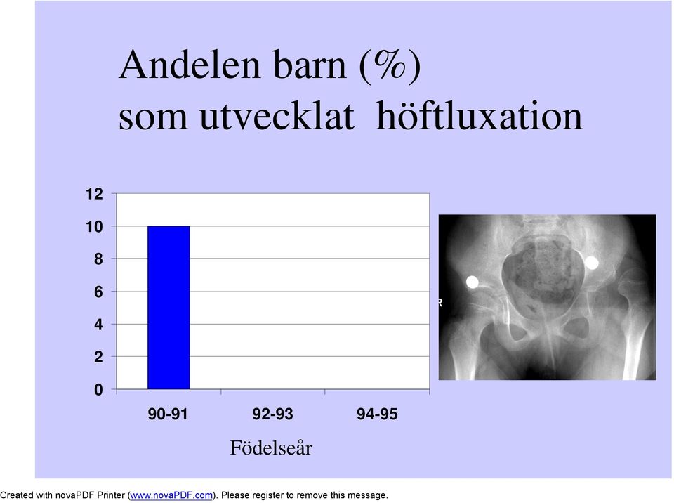 höftluxation 12 10 8