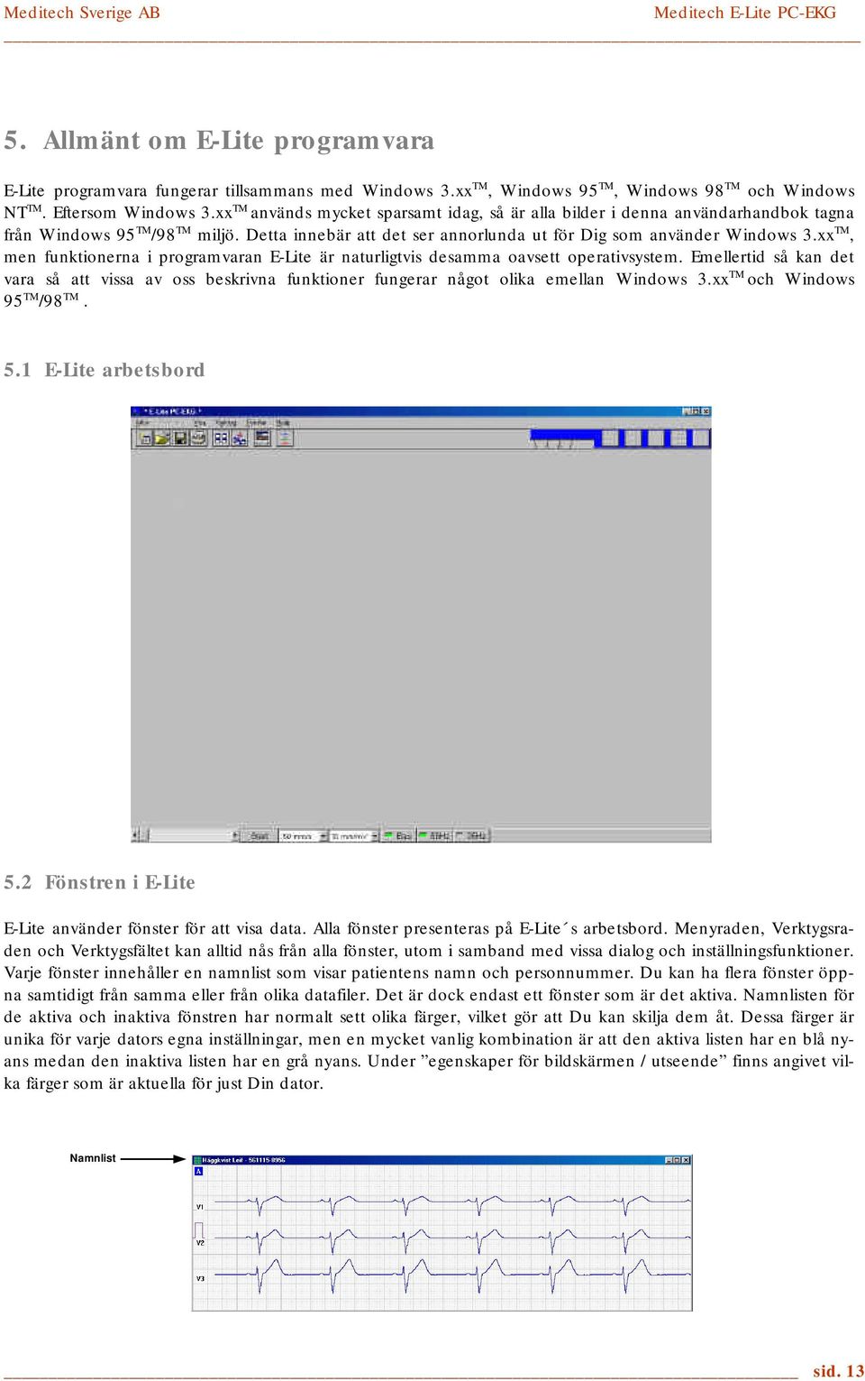 xx TM, men funktionerna i programvaran E-Lite är naturligtvis desamma oavsett operativsystem.