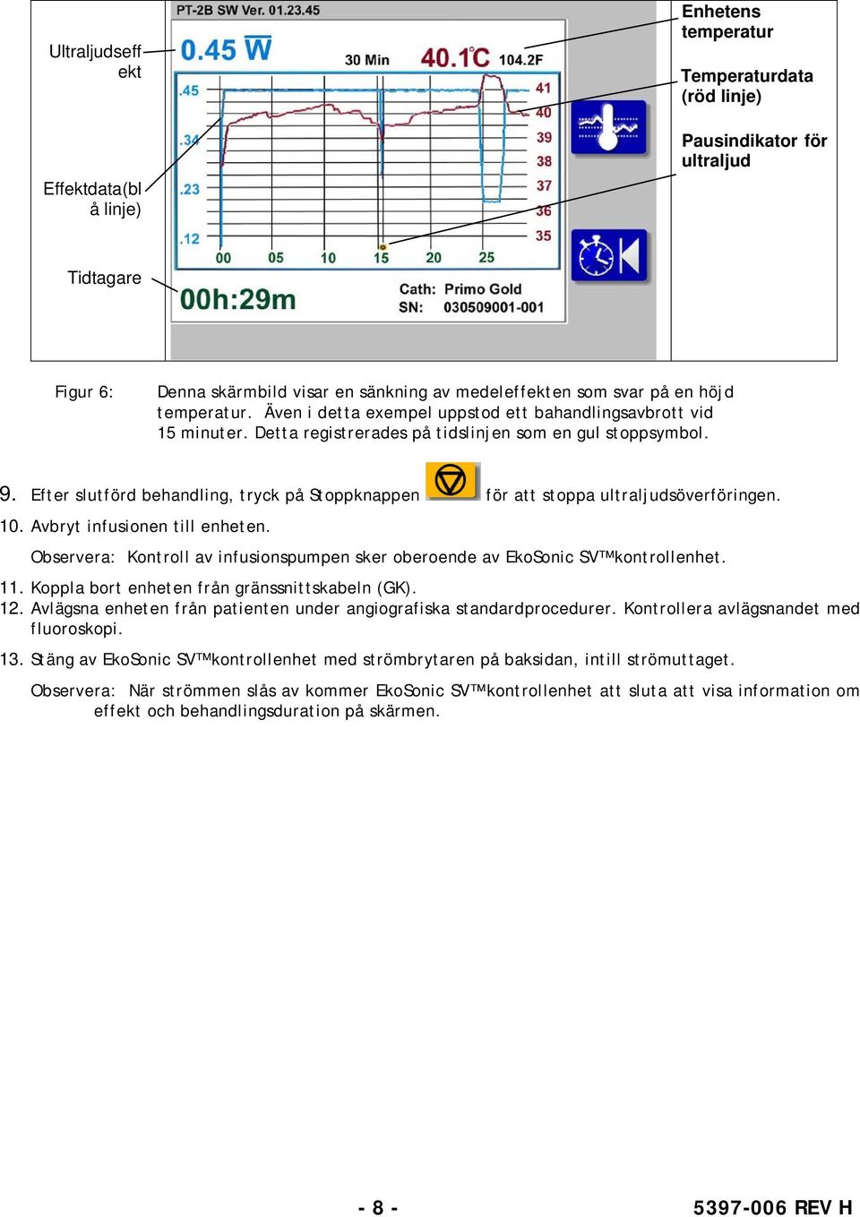 Efter slutförd behandling, tryck på Stoppknappen för att stoppa ultraljudsöverföringen. 10. Avbryt infusionen till enheten.