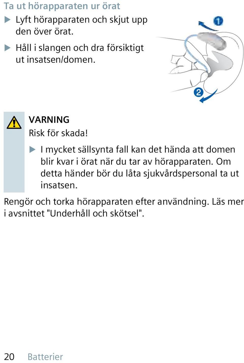 u I mycket sällsynta fall kan det hända att domen blir kvar i örat när du tar av hörapparaten.