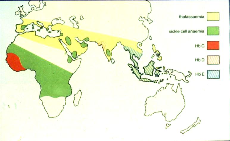 Hemoglobinopatier De vanligaste av ärftliga sjukdomarna WHO