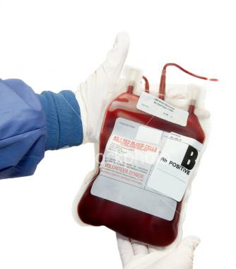 Blodtransfusioner Vanligaste orsaken En