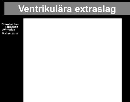 Jordelektrodens uppgift vid EKGregistrering Patienten ska läggas på samma elektriska nivå som jorden.