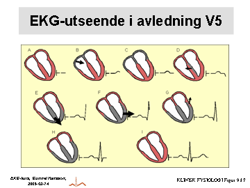 Rvåg P = förmaksdepolarisering QRS = kammardepolarisering Pvåg STsträcka Tvåg Uvåg T = kammarrepolarisering PQ = baslinje Qvåg Jpunkt Svåg P QRSduration duration PQtid QTtid KLINISK FYSIOLOGI Figur